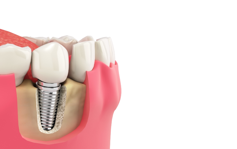 噛み合わせが全身に与える影響