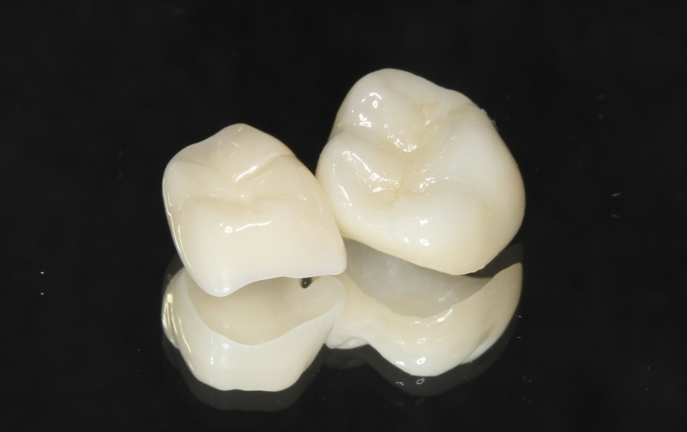 セラミックとは？