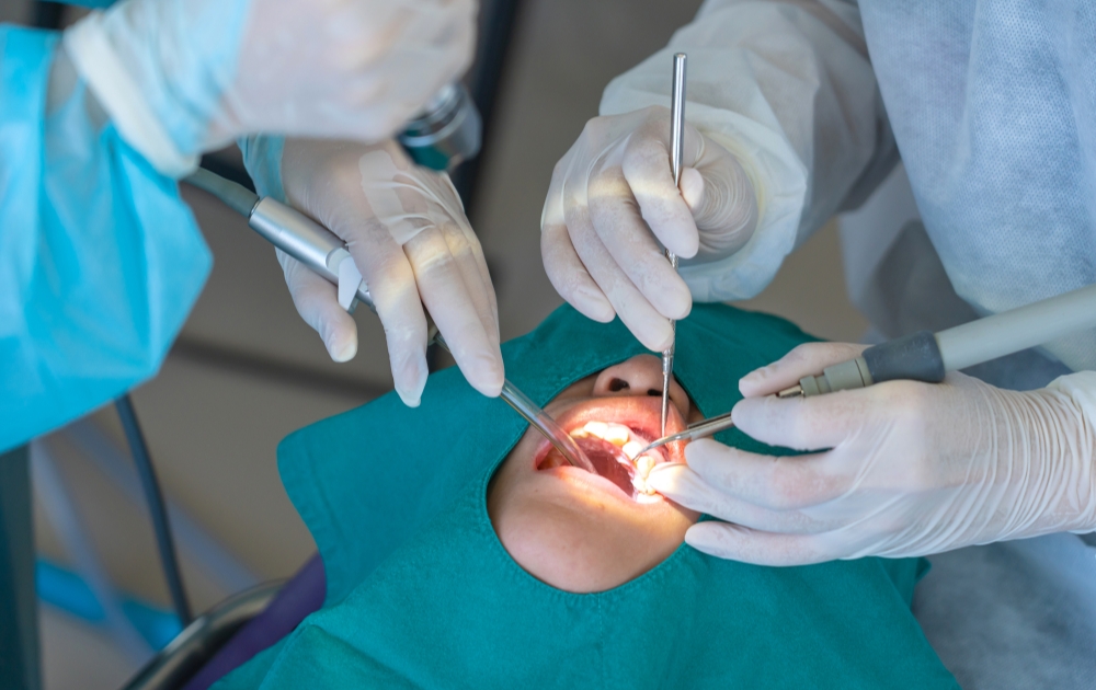 2.歯石取り・クリーニング