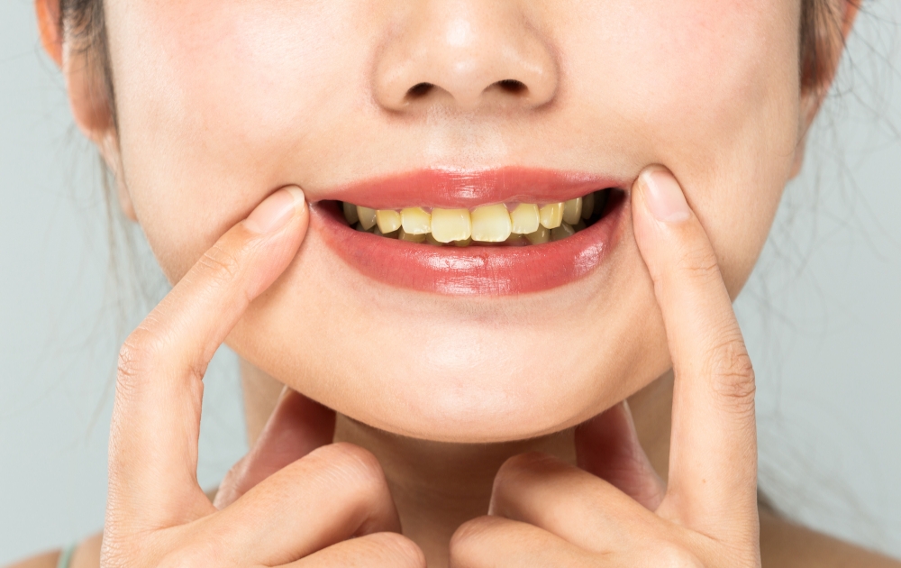 歯の汚れでお悩みはありませんか？