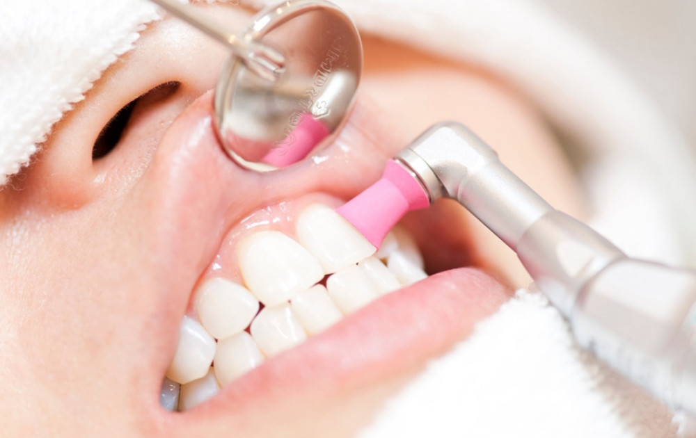 3.清潔感があり綺麗な口元に