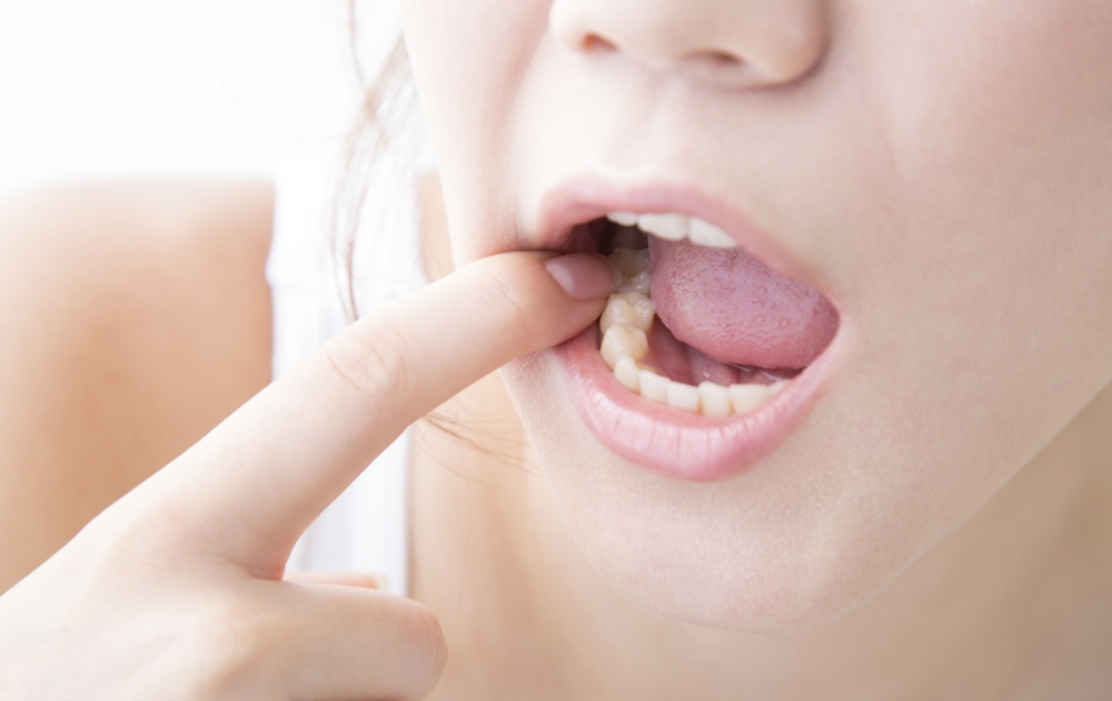 歯周病を自覚することが大事