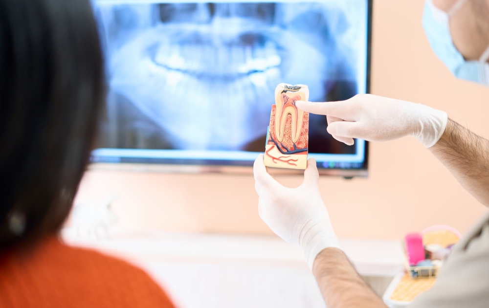 歯周病の主な原因とは？