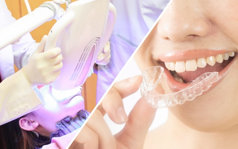 デュアルホワイトニング